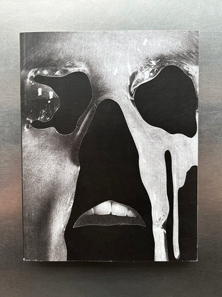 Misophonia: Jesse Draxler